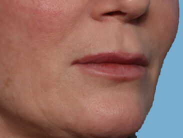 Case # 3 before photo