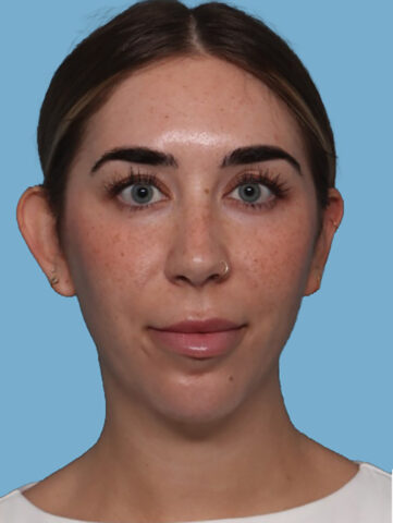 Case # 6 after photo