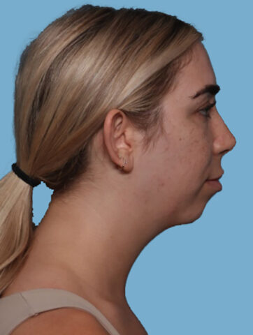 Case # 6 before photo