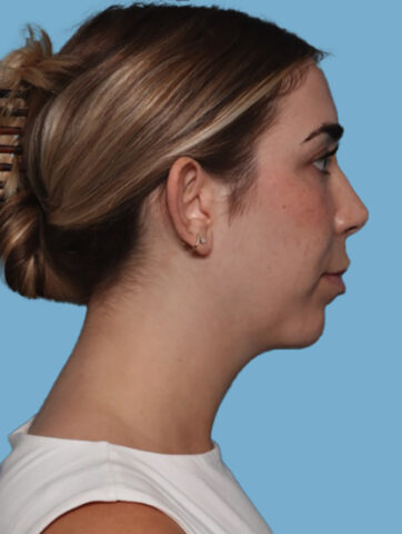 Case # 6 after photo