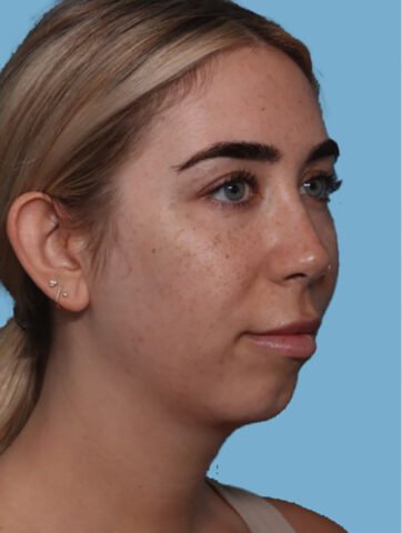 Case # 6 before photo