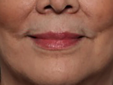 Case # 4 before photo