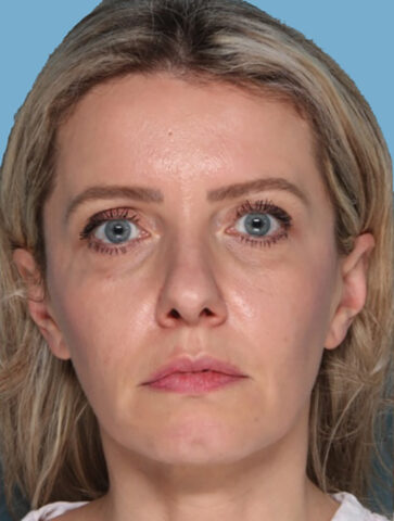 Case # 4 before photo