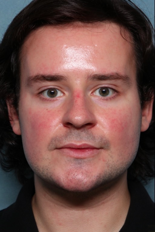 Case # 16 after photo