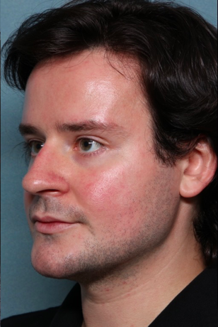 Case # 16 after photo