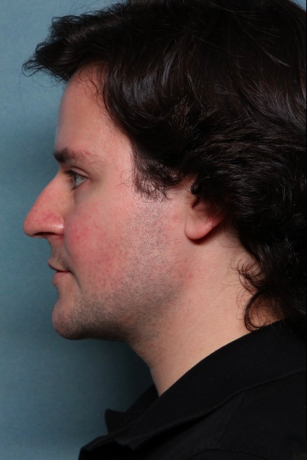 Case # 16 after photo