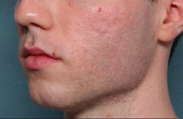 Case # 21 after photo