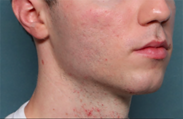 Case # 21 after photo