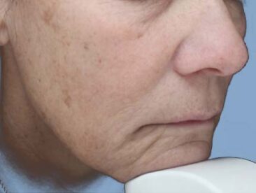 Case # 41 before photo