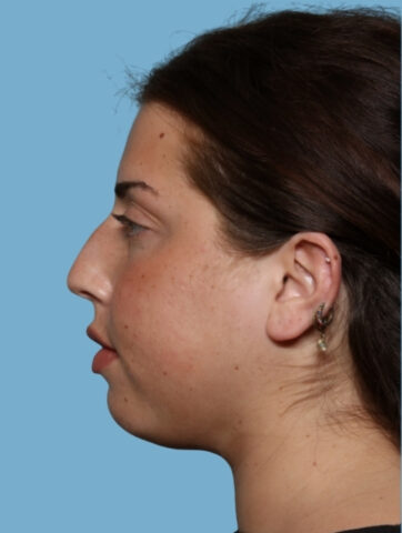 Case # 7 before photo