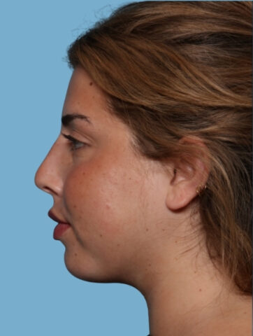 Case # 7 after photo