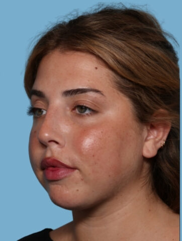 Case # 7 after photo