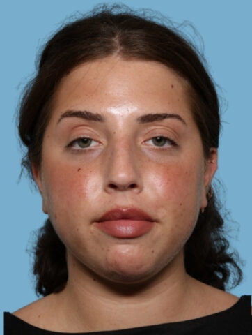 Case # 7 before photo