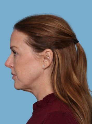 Case # 2 before photo