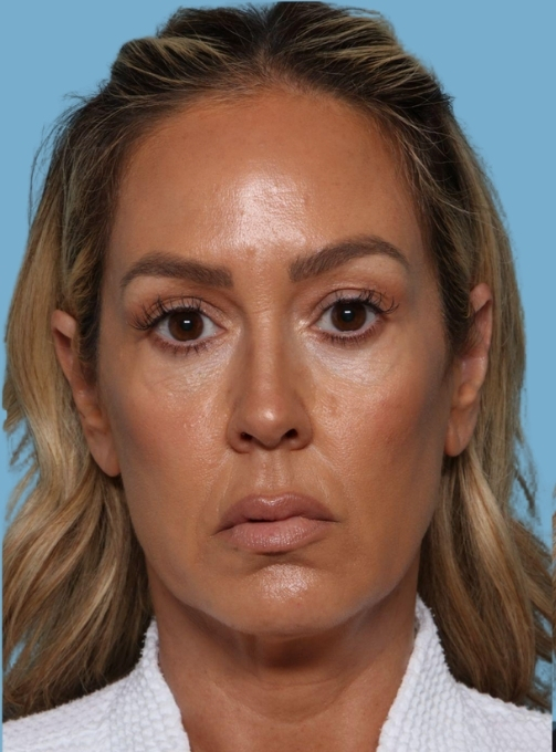 before and after gallery image